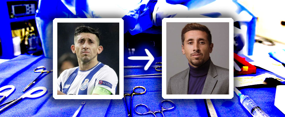 Before and after: 8 soccer players with cosmetic surgeries