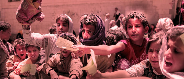 Yemen: children are the most affected due to the war Yemen: children are the most affected due to the war
