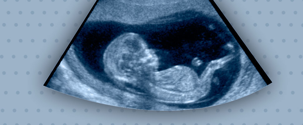 Do you want to see your baby? Technologies to see him inside the womb