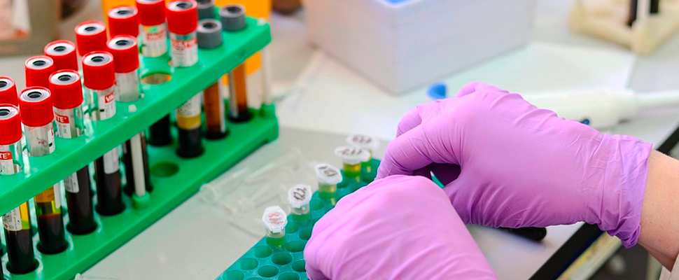 Mujer en laboratorio organizando muestras de sangre.