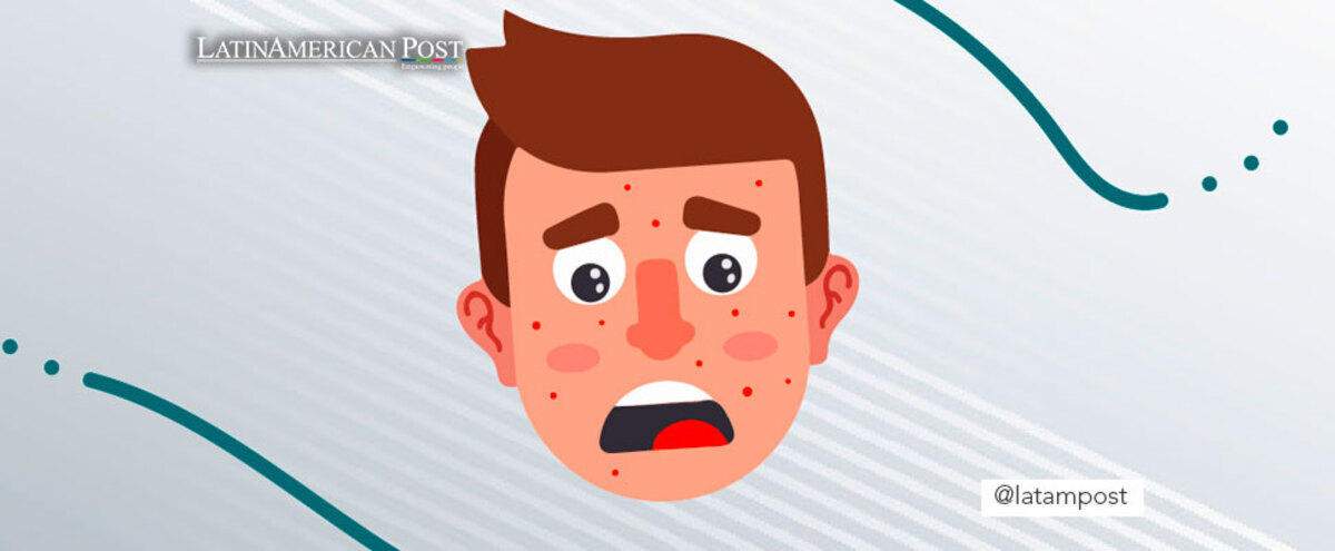 vector of boy with measles