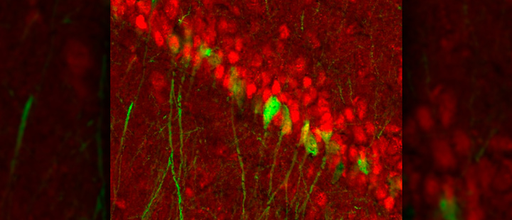 Scientists find gender-distinct circuit for depression Scientists find gender-distinct circuit for depression